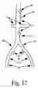 Fig. 06 - Embolic protection device for the prevention of stroke