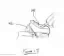 Fig. 12 - System and method for controlling electrical stimulation and radiofrequency output for use in an electrosurgical procedure