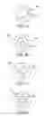 Fig. 02 - Dual function prosthetic bone implant and method for preparing the same