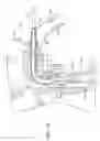 Fig. 05 - Device for insertion of endotracheal tube