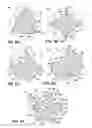 Fig. 04 - Non-landed endodontic instrument and methods of making such endodontic instruments