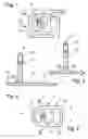 Fig. 02 - Dental implant and method of insertion