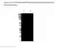 Fig. 11 - BMP-3 propeptides and related methods