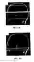 Fig. 02 - Multi-slice cerebral blood flow imaging with continuous arterial spin labeling MRI