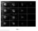 Fig. 09 - Adaptive control of optical pulses for laser medicine