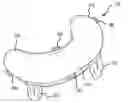 Fig. 01 - Back support attachment for nursing pillows