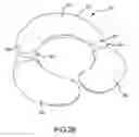 Fig. 15 - Back support attachment for nursing pillows