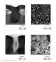 Fig. 02 - Cell fractions containing cells capable of differentiating into neural cells