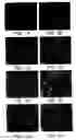 Fig. 02 - Methods of use of viral vectors to deliver antigen to dendritic cells