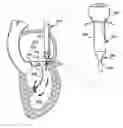 Fig. 01 - Sizing apparatus