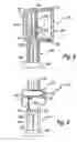 Fig. 04 - High temperature pressure transmitter assembly