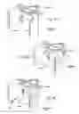 Fig. 23 - Devices, systems, and methods to fixate tissue within the regions of body, such as the pharyngeal conduit