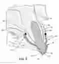 Fig. 04 - Custom mouthguard