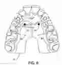 Fig. 07 - Custom mouthguard