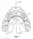 Fig. 08 - Custom mouthguard