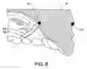 Fig. 09 - Custom mouthguard