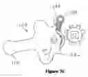 Fig. 17 - Clamp and lock for paint mixer
