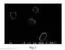 Fig. 03 - Medium and method for preserving platelets, red blood cells, and other non-nucleus cells and platelets-containing composition