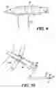 Fig. 15 - Left ventricular conduits and methods for delivery