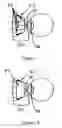 Fig. 09 - Method and device for optical ophthalmic therapy