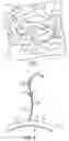 Fig. 02 - Corpus callosum neuromodulation assembly