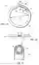 Fig. 02 - Adjustable cardiac valve implant with selective dimensional adjustment