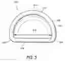 Fig. 06 - Adjustable cardiac valve implant with selective dimensional adjustment