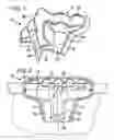 Fig. 02 - Overhang edge shipping protector