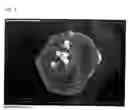 Fig. 02 - Pharmaceutical porous particles