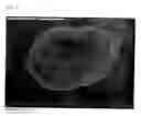 Fig. 03 - Pharmaceutical porous particles