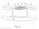 Fig. 09 - Methods for evaluating anticaries efficacy in occlusal surfaces of teeth