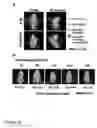 Fig. 07 - Modified sodium iodide symporter proteins and genes for imaging and cancer therapy