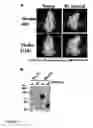 Fig. 09 - Modified sodium iodide symporter proteins and genes for imaging and cancer therapy