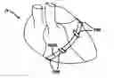 Fig. 01 - Systems and methods for assisting cardiac valve coaptation