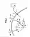 Fig. 04 - Systems and methods for assisting cardiac valve coaptation