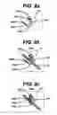 Fig. 08 - Systems and methods for assisting cardiac valve coaptation