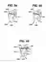 Fig. 09 - Systems and methods for assisting cardiac valve coaptation