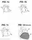 Fig. 02 - Systems and methods for sizing cardiac assist device