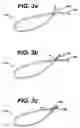 Fig. 04 - Systems and methods for sizing cardiac assist device