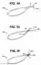 Fig. 05 - Systems and methods for sizing cardiac assist device