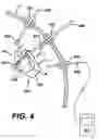 Fig. 06 - Systems and methods for sizing cardiac assist device