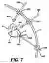 Fig. 09 - Systems and methods for sizing cardiac assist device
