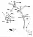 Fig. 13 - Systems and methods for sizing cardiac assist device