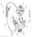 Fig. 03 - Image-type intubation-aiding device