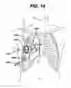 Fig. 20 - Low profile surgical retractor