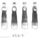 Fig. 04 - Devices, methods, and kits for non-invasive glucose measurement