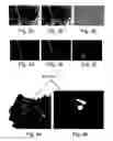 Fig. 04 - Optical examination method and apparatus particularly useful for real-time discrimination of tumors from normal tissues during surgery