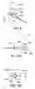 Fig. 09 - Delivery methods and devices for implantable bronchial isolation devices