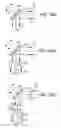 Fig. 32 - Methods and products for producing lattices of EMR-treated islets in tissues, and uses therefor