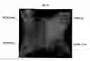 Fig. 50 - Methods and products for producing lattices of EMR-treated islets in tissues, and uses therefor